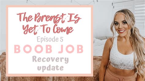 Boob Job Recovery Update Months Post Op Scar Treatment How To My Xxx Hot Girl