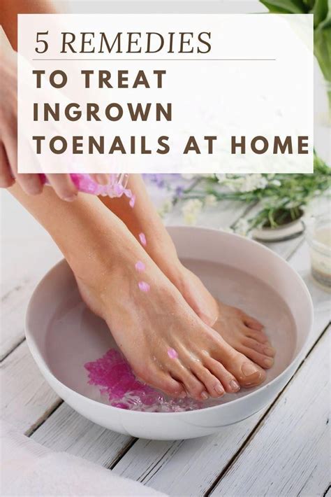 Follow These Natural Steps To Treat Ingrown Toenails At Home Home