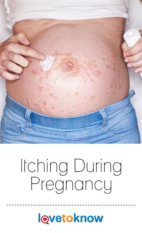 Itchy Skin During Pregnancy Is Quite Common And The Intensity Of The
