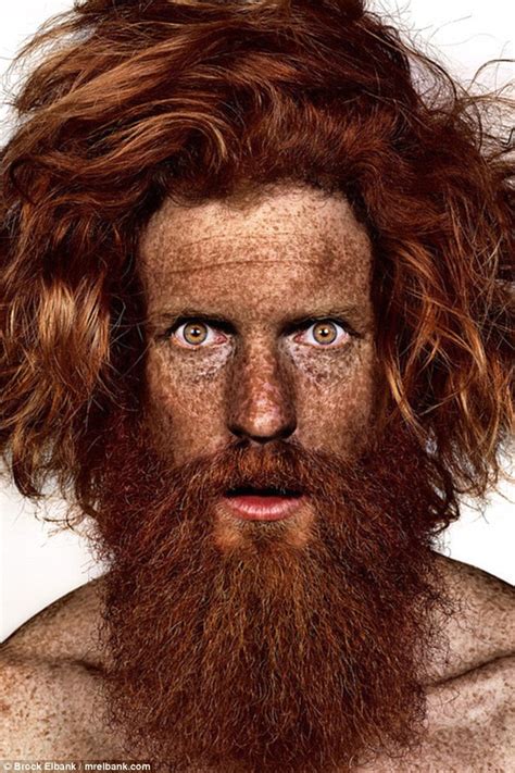 Photographer Brock Elbank Captures Men And Women Covered In Freckles Daily Mail Online