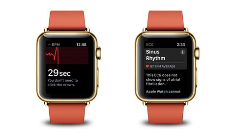 Apple Watch Series 4 Users Outside Of Us Region Cant Enable Ecg