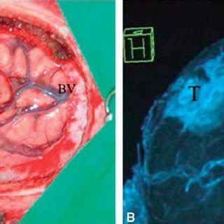 Each of the rows records data independently as the gantry rotates; Serkan GELMEZ | Acibadem Hospitals Group, Istanbul | Radiology
