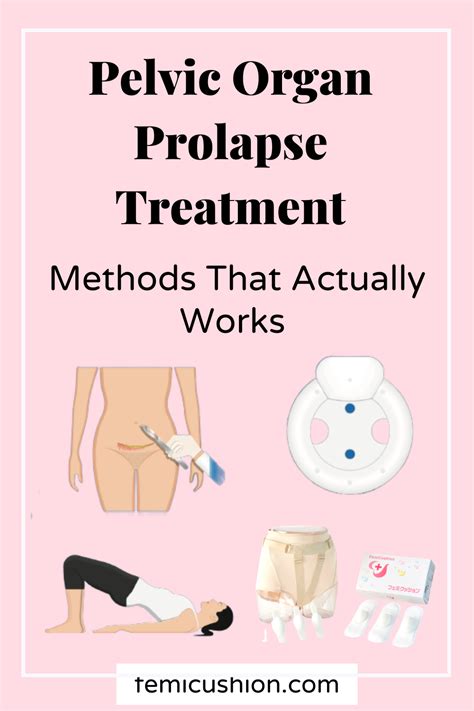 How To Overcome Pelvic Organ Prolapse Prolapse Treatment Options Artofit