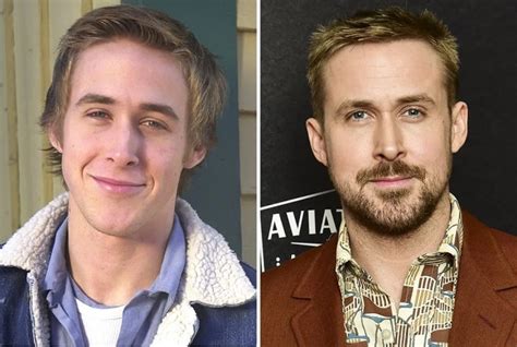 Ryan Gosling Before And After Plastic Surgery Nose Teeth