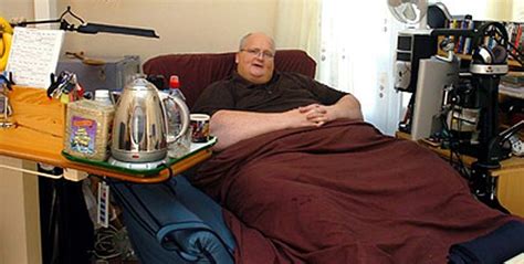 Former Worlds Fattest Man Begs For Nhs Operation To Remove Folds Of