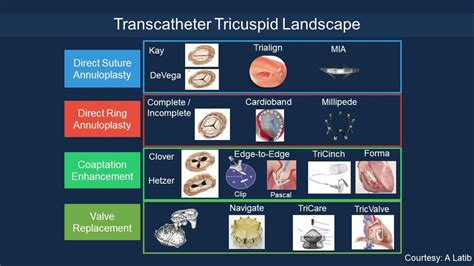 Tricuspid Clip In Tricuspid Regurgitation American College Of Cardiology