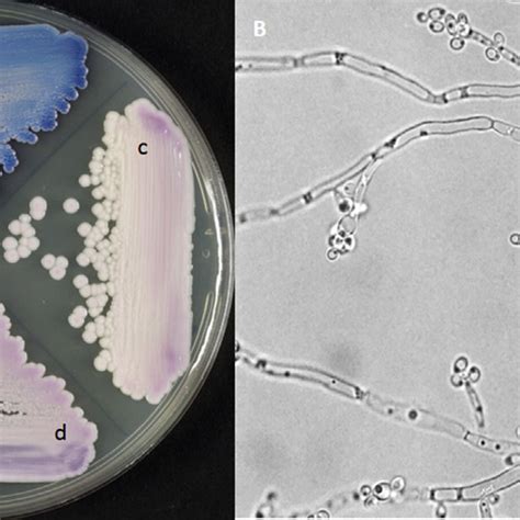 A Chromagar Candida Showing Colony Characteristics Of The Following