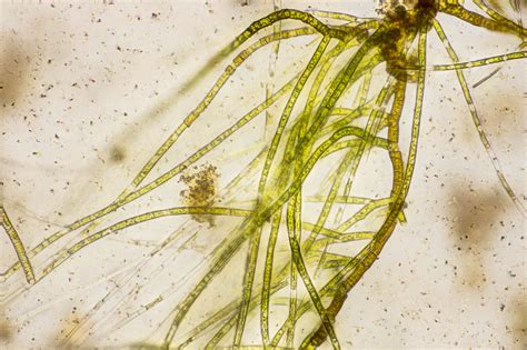 Cladophora The Microscopic Life Of Shetland Lochs