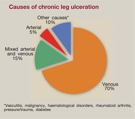 Chronic Ulceration Of The Leg Surgery Oxford International Edition