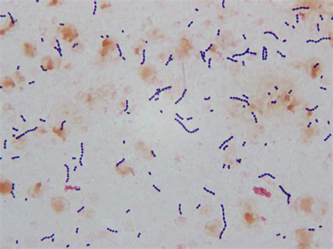 Uragano Canzone Cristiano Streptococcus Pyogenes Gram Stain Graffiare