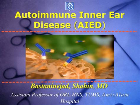 Ppt Autoimmune Inner Ear Disease Aied Powerpoint Presentation