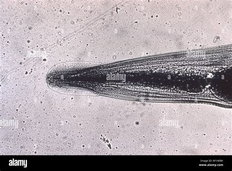 Human Pinworm Enterobius Vermicularis Cephalic Alae In The Head