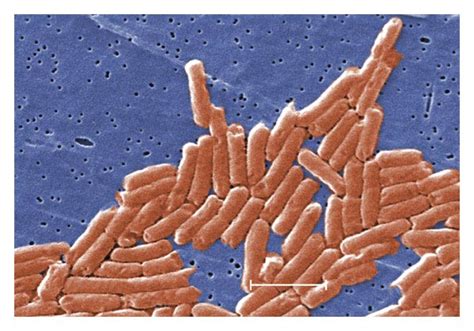 Salmonella enterica serovar typhimurium infection. Salmonella Update | Clinical Correlations