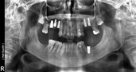 Imagen Maxilofacial Radiología Dental En 3d