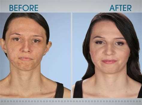 See The Most Incredible Before And After Botched Transformations E News