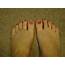 Dr Scholls Shoes Nyc Outgrow For Ingrown Toenails Pictures Top Of 