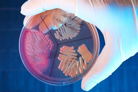 12 Doenças Causadas Por Bactérias Sintomas E Tratamento Tua Saúde