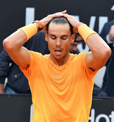 Rafael Nadal Hair Loss Hair Loss
