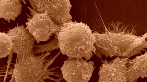 Cancer Biology | Molecular, Cellular and Developmental Biology