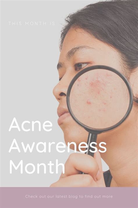 Acne Awareness Month What Is Acne Awareness Month Awareness Acne