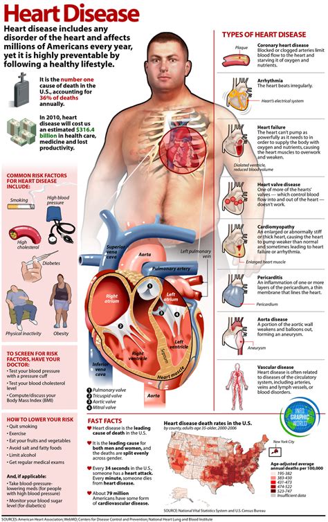 All About Heart Disease Infographic NaturalON Natural Health News
