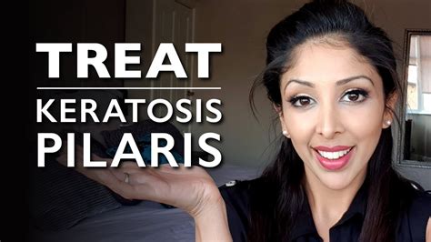 Keratosis Pilaris From Doctor V Kp Treatment Chicken Skin How To