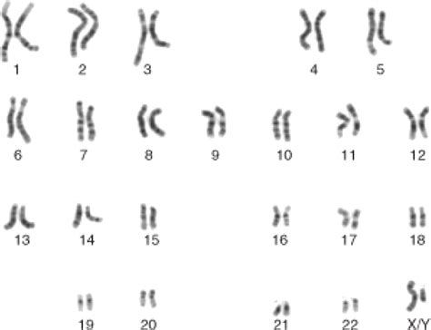 the 24 human chromosomes male karyotype clipart large size png image pikpng