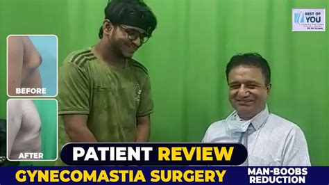 Patient Review Gynecomastia Surgery Male Boob Reduction And Correction Results By Dr Pk