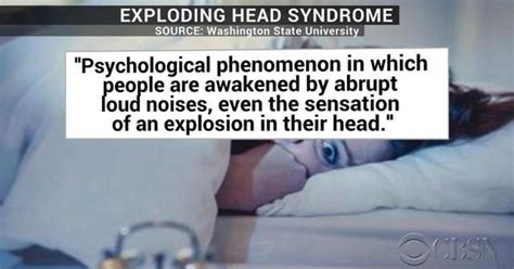 Whats Exploding Head Syndrome Cbs News