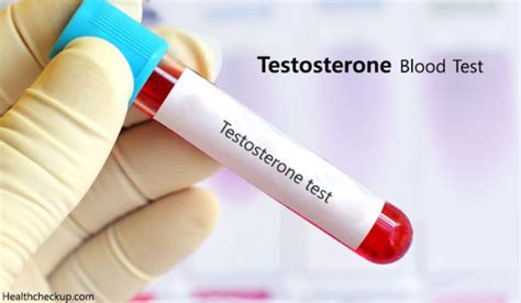 Testosterone Blood Test Procedure Preparation And Normal Levels Of