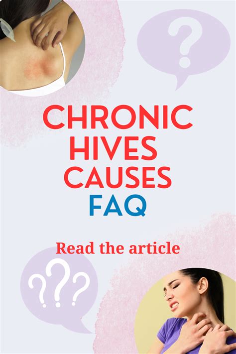 Chronic Hives Causes A Functional Medicine Perspective Thrive With