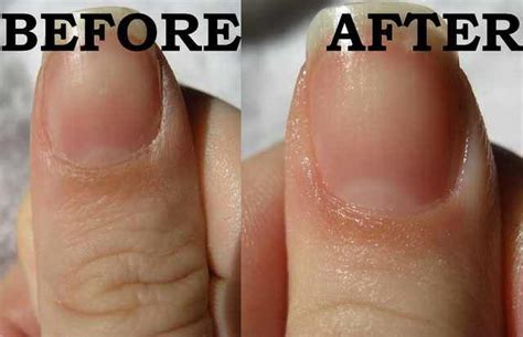 Cuticle Care Imgur Beauty Nails Cuticle Care Natural Nail Care