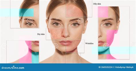 Collage Female Skin Problems Close Up Stock Photo Image Of Face