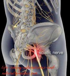 What causes sciatic nerve pain? Here's How to Use Tennis Ball to Relieve Your Sciatic Pain ...