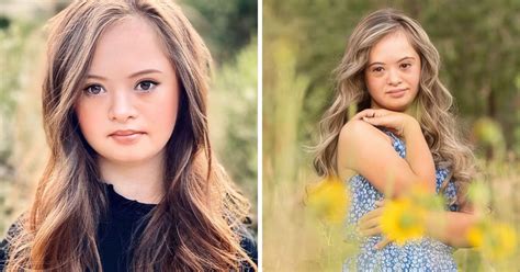 A Girl With Down Syndrome Beats Doctors Odds And Grows Into A Stunningly Beautiful Model