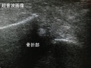 池田医院 整形外科 外科 リハビリ