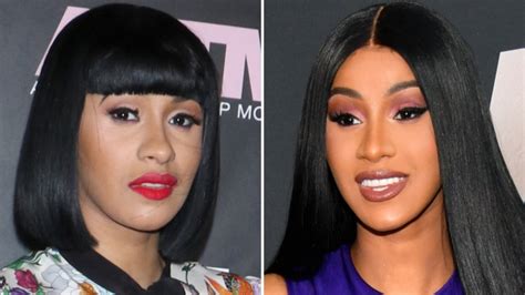 Cardi B Transformation And Plastic Surgery Speculation Photos