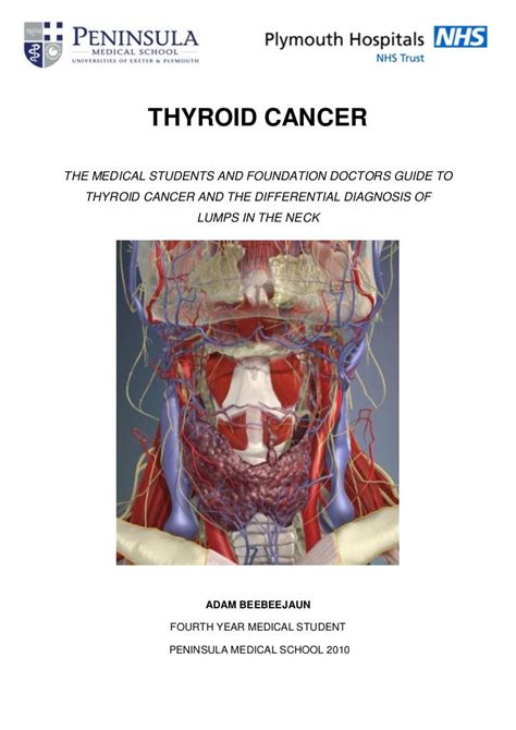 Thyroid Cancer And Differential Diagnosis Of Lumps In Neck For Medical