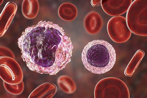 Lymphocytes Bas élevés Définition Causes Et Examen