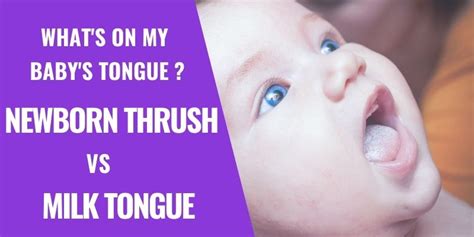 Thrush Vs Milk Tongue Atelier Yuwaciaojp