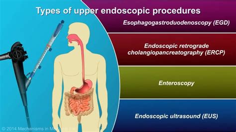 Endoscopic Procedure Youtube