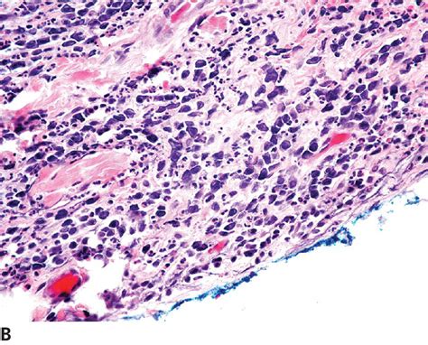 Mast Cell Tumors Veterian Key