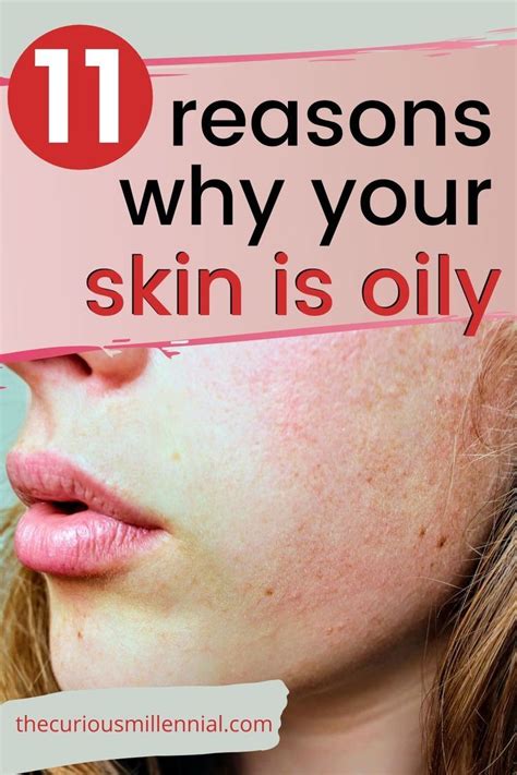 11 Surprising Reasons Why Your Skin Is Oily Treating Oily Skin Skin