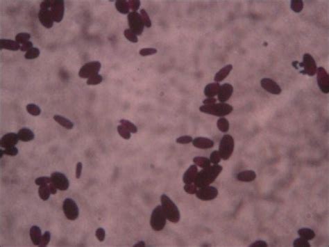 Candida Albicans Gram Stain