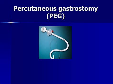 Ppt Procedural Gastroenterology A Brief Overview Powerpoint