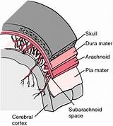 Pictures of Cerebro Medical Term