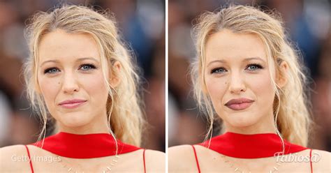 Do Full Lips Suit Every Woman 7 Celebrities With Fake