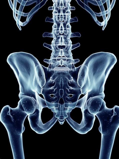 Human Hip Bones Photograph By Sebastian Kaulitzkiscience Photo Library