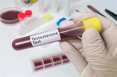 Scientists Use Stem Cells To Restore Testosterone