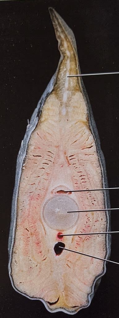 Cva Lamprey Between Anterior And Posterior Dorsal Fins Diagram Quizlet